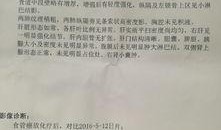 爆料癌症治疗案例最新版,揭秘最新癌症治疗案例的奇迹疗法